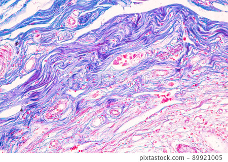 Tissue of Small intestine (Duodenum) and Vermiform appendix  Human under the microscope in Lab. 89921005