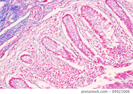 Tissue of Small intestine (Duodenum) and Vermiform appendix Human under the microscope in Lab. Tissue of Small intestine (Duodenum) and Vermiform appendix Human under the microscope in Lab. 89921006
