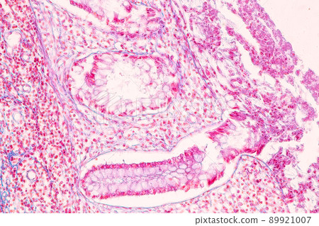Tissue of Small intestine (Duodenum) and Vermiform appendix  Human under the microscope in Lab. 89921007