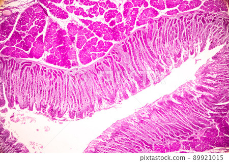 Tissue of Small intestine (Duodenum) and Vermiform appendix Human under the microscope in Lab. Tissue of Small intestine (Duodenum) and Vermiform appendix Human under the microscope in Lab. 89921015