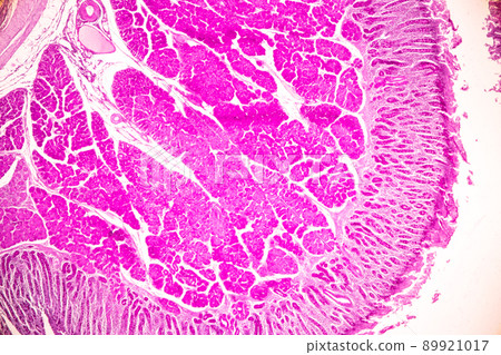 Tissue of Small intestine (Duodenum) and Vermiform appendix  Human under the microscope in Lab. 89921017