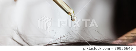 Oil from a pipette drips onto the hair on the head Oil from a pipette drips onto the hair on the head 89936649