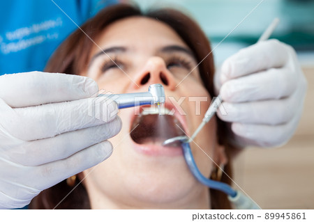 Closeup of a dental bur being used by the dentist during a dental treatment for a beautiful woman. 89945861