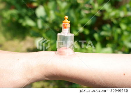 吸毒機，除毒器吸出昆蟲叮咬的毒物 89946486