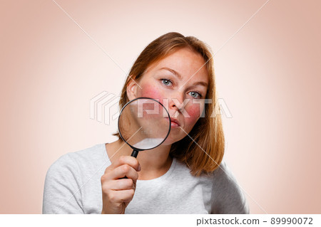 Portrait of a woman showing redness on her cheeks, through a magnifying glass. Pink background. The concept of rosacea 89990072
