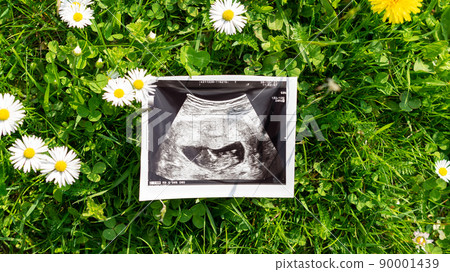 Ultrasound image pregnant baby photo. Ultrasound pregnancy picture on grass flowers background. Concept of pregnancy, maternity, expectation for baby birth. Ultrasound image pregnant baby photo. Ultrasound pregnancy picture on grass flowers background. Concept of pregnancy, maternity, expectation for baby birth. 90001439
