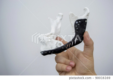 Man holding implantation of endoprosthesis of lower jaw. Model of lower jaw printed on 3D printer white plastic. Endoprosthesis printed on 3D printer for metal biocompatible titanium alloy black color 90016169
