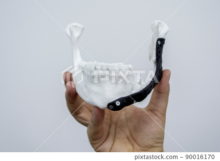 Man holding implantation of endoprosthesis of lower jaw. Model of lower jaw printed on 3D printer white plastic. Endoprosthesis printed on 3D printer for metal biocompatible titanium alloy black color Man holding implantation of endoprosthesis of lower jaw. Model of lower jaw printed on 3D printer white plastic. Endoprosthesis printed on 3D printer for metal biocompatible titanium alloy black color 90016170