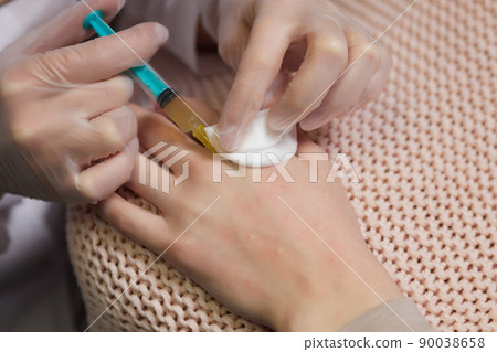 Doctor doing stem cell therapy on a patient's elbow after the injury. Treating knee pain with platelet-rich plasma injection. Treatment of arthritis and osteoarthritis.Medical and cosmetology concept. Doctor doing stem cell therapy on a patient's elbow after the injury. Treating knee pain with platelet-rich plasma injection. Treatment of arthritis and osteoarthritis.Medical and cosmetology concept. 90038658