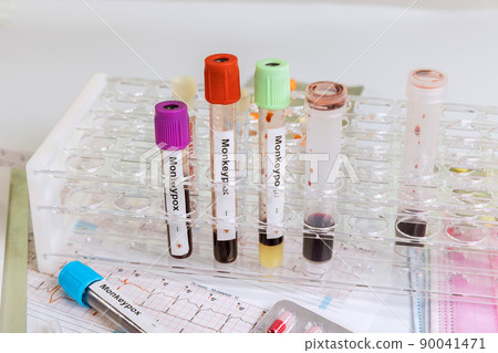 Laboratory in check-up analysis blood test for smallpox Monkey infection blood test Laboratory in check-up analysis blood test for smallpox Monkey infection blood test 90041471