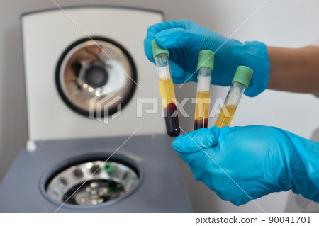Platelet-Rich plasma preparation. Plasma in syringe. Centrifuge. 90041701