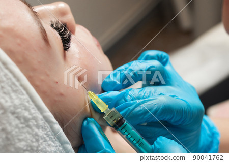 Syringe with a patient's blood plasma in a cosmetologist's hand for a plasmolifting of a woman's facial skin. Plasma therapy, skin cell restoration. 90041762