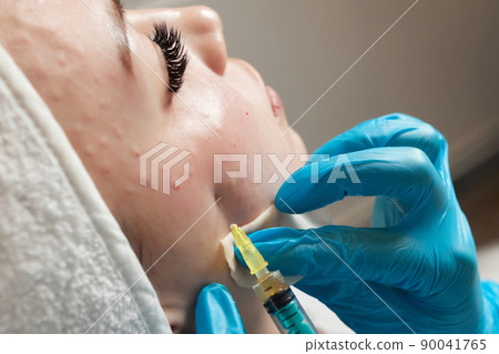 Syringe with a patient's blood plasma in a cosmetologist's hand for a plasmolifting of a woman's facial skin. Plasma therapy, skin cell restoration. 90041765