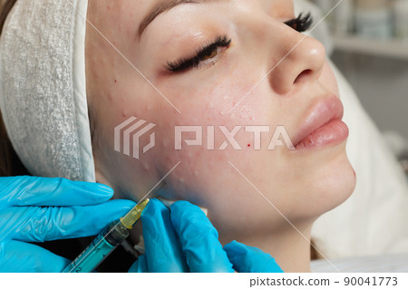 Syringe with a patient's blood plasma in a cosmetologist's hand for a plasmolifting of a woman's facial skin. Plasma therapy, skin cell restoration. 90041773