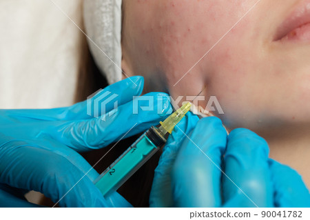 Syringe with a patient's blood plasma in a cosmetologist's hand for a plasmolifting of a woman's facial skin. Plasma therapy, skin cell restoration. 90041782