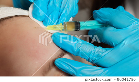 Syringe with a patient's blood plasma in a cosmetologist's hand for a plasmolifting of a woman's facial skin. Plasma therapy, skin cell restoration. 90041786