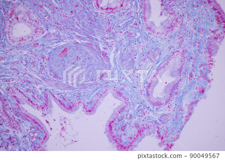 Columnar epithelium of human gall bladder under the microscope in Lab. 90049567