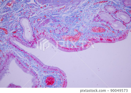 Columnar epithelium of human gall bladder under the microscope in Lab. 90049573