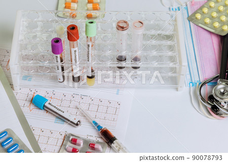 Monkeypox virus infection blood sample test with pills, tablets blood test in laboratory Monkeypox virus infection blood sample test with pills, tablets blood test in laboratory 90078793