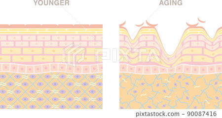 Cross section of young and aging skin, deep.... - Stock Illustration ...