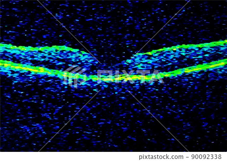 Green blue pixel particles abstract texture network big data background 90092338