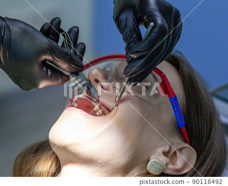 A woman at a dentist's appointment to replace arches with braces 90118492