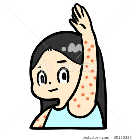 A child with eczema on his arm - Stock Illustration [90120325] - PIXTA