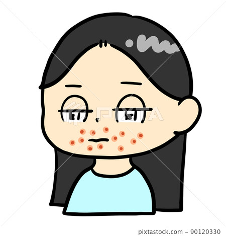 A child with eczema around his mouth 90120330