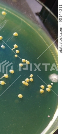 Observation of colonies of various shapes Observation of colonies of various shapes 90144311