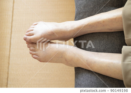 Swelling of the feet of the elderly 90149198