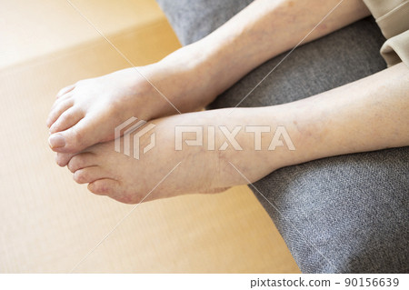 老人腳腫 老人腳腫 90156639