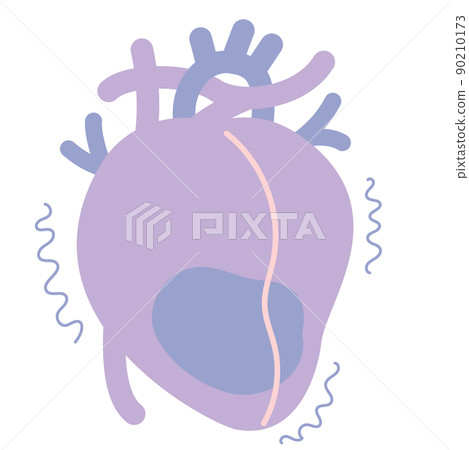 Heart that causes ventricular fibrillation Heart that causes ventricular fibrillation 90210173