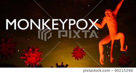 Illustration of monkeypox, infectious disease caused by the monkey pox virus. Multi-country outbreak, the new cases. Viral zoonotic disease, dangerous infection. 90215298