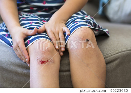 Close-up of little girl holding her bruised injured damaged knee with her hands 90225680