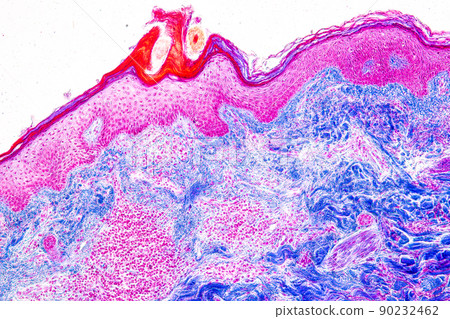 Scalp and hair follicles of human under the microscope in Lab. 90232462