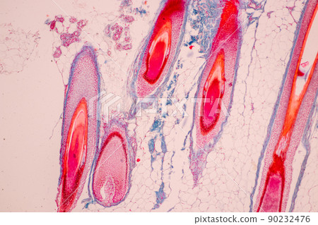 Scalp and hair follicles of human under the microscope in Lab. Scalp and hair follicles of human under the microscope in Lab. 90232476