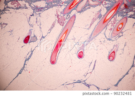 Scalp and hair follicles of human under the microscope in Lab. Scalp and hair follicles of human under the microscope in Lab. 90232481