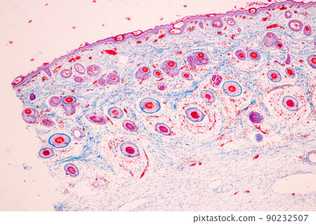 Scalp and hair follicles of human under the microscope in Lab. Scalp and hair follicles of human under the microscope in Lab. 90232507