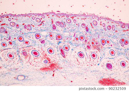 Scalp and hair follicles of human under the microscope in Lab. 90232509