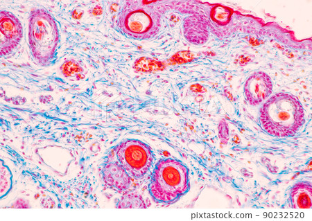 Scalp and hair follicles of human under the microscope in Lab. Scalp and hair follicles of human under the microscope in Lab. 90232520