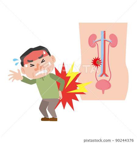 患有輸尿管結石疼痛的男人 患有輸尿管結石疼痛的男人 90244376