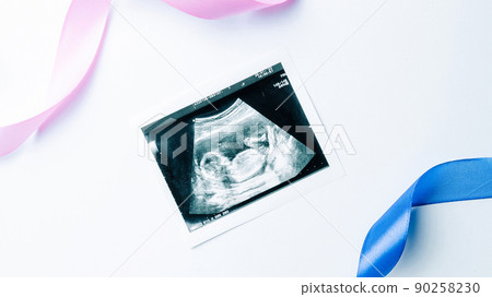 Ultrasound picture pregnant baby photo. Blue, pink ribbon with ultrasound pregnancy image on white background. Pregnancy, medicine, pharmaceutics, health care and people concept. 90258230
