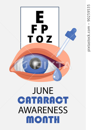 Cataract awareness month is celebrated in June. Glaucoma disease and nephropathy problems. Ophthalmologist, oculist concept illustration. Cataract awareness month is celebrated in June. Glaucoma disease and nephropathy problems. Ophthalmologist, oculist concept illustration. 90259535