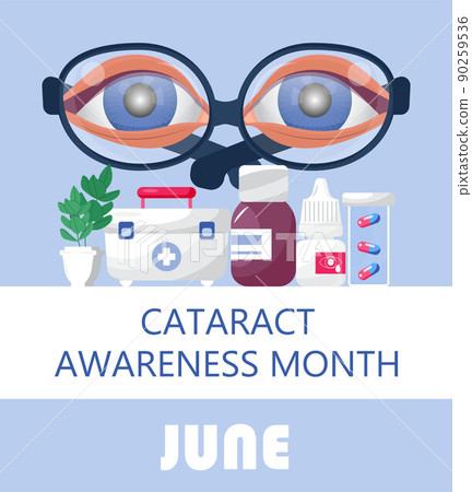 Cataract awareness month is celebrated in June. Glaucoma disease and nephropathy problems. Ophthalmologist, oculist concept illustration. Cataract awareness month is celebrated in June. Glaucoma disease and nephropathy problems. Ophthalmologist, oculist concept illustration. 90259536