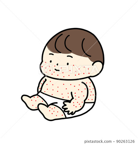 Baby with a rash all over the body 90263126