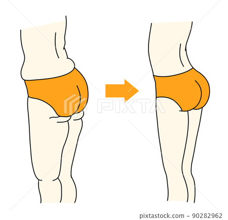 Before and after illustrations of the shape of the abdomen, hips, buttocks, and legs Before and after illustrations of the shape of the abdomen, hips, buttocks, and legs 90282962