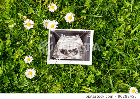 Ultrasound image pregnant baby photo. Ultrasound pregnancy picture on grass flowers background. Concept of pregnancy, maternity, expectation for baby birth. 90288455