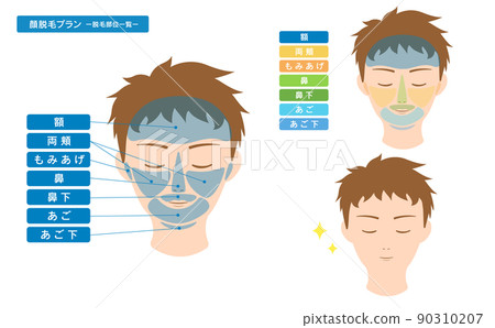 List of male hair loss points Face hair loss 90310207