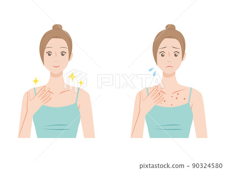 患有肩部痤瘡的女性 90324580