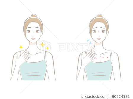A woman suffering from décolletage acne - Stock Illustration [90324581 ...